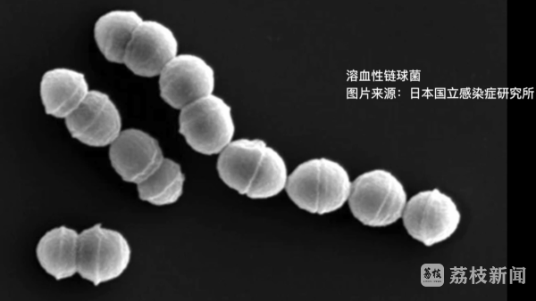 真牛所配资 正在日本流行的“食人菌”是什么？如何预防？